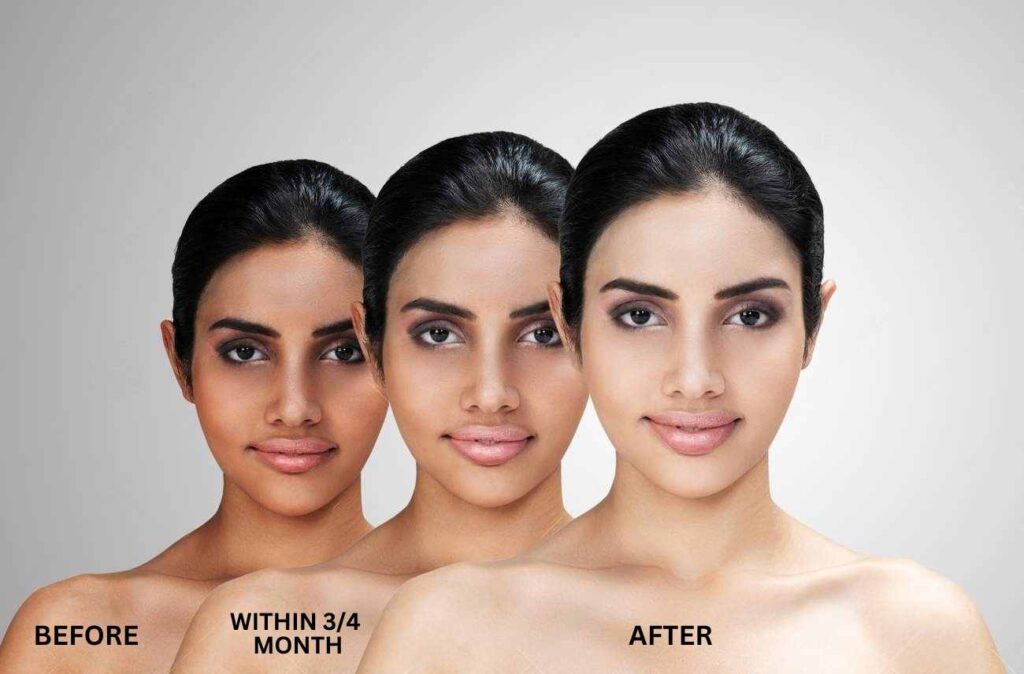Full Body Whitening Treatment