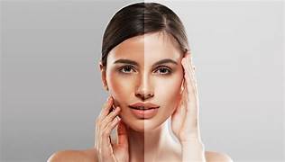 Skin Tan Removal
